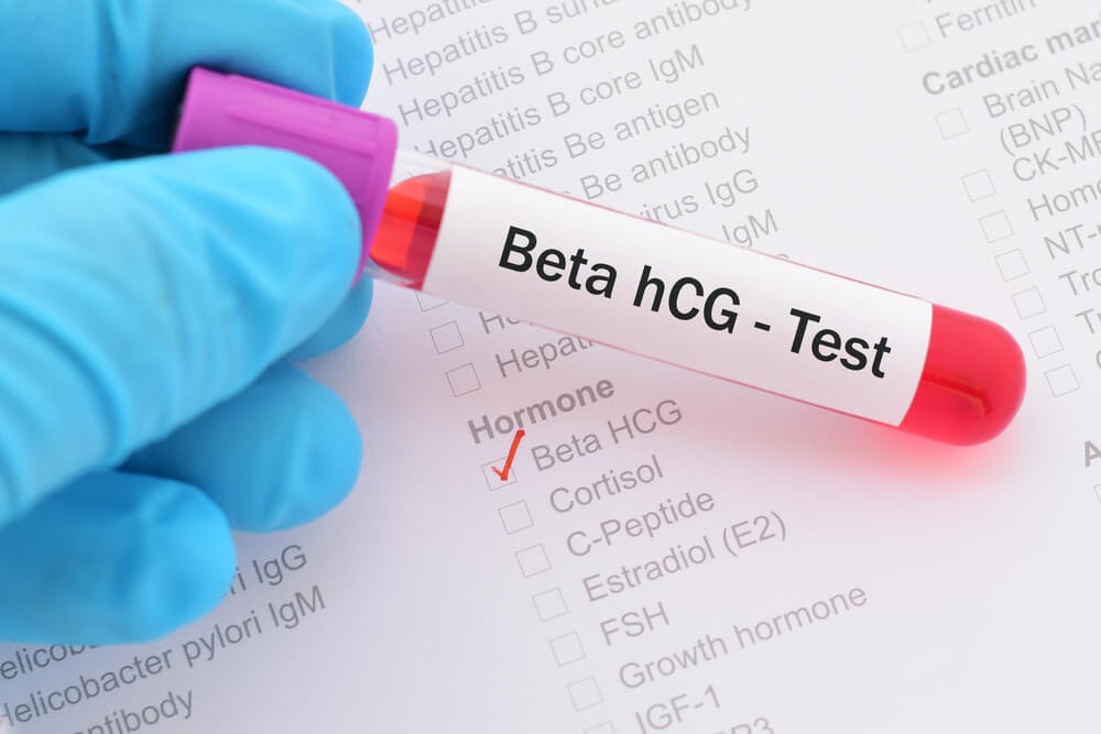 BETA HCG NEDİR? BETA HCG DEĞERİ KAÇ OLMALIDIR? DÜŞÜKLÜĞÜ VE YÜKSEKLİĞİ NE ANLAMA GELİR?